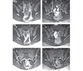 The role of imaging methods in the diagnosis and management of axial spondyloarthritis