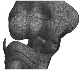Біомеханічне визначення стабільності  ліктьового суглоба при переломах головки променевої кістки, комбінованих  із пошкодженням колатеральних зв’язок