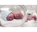 Диференційний підхід до діагностики  раннього неонатального сепсису  в передчасно народжених дітей