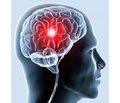 Нейрофізіологічні предиктори відношень «кровотік — метаболізм» за умов хронічної ішемії мозку