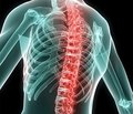 Treatment of spine injuries in patients with polytrauma