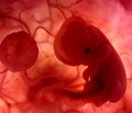 Особенности объемного кровотока хориона  и допплерометрические характеристики кровотока  в маточных артериях у беременных с угрозой прерывания  в первом триместре на фоне гипопрогестеронемии