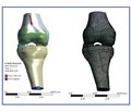Біомеханічне обґрунтування розвитку та прогресування структурних змін у травмованому хрящі колінного суглоба