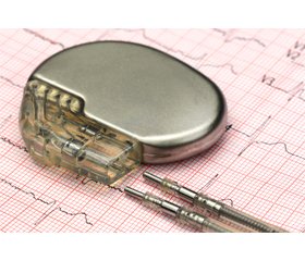 Створення рекомендацій щодо втручання iPhone 12 в роботу імплантованих серцевих приладів