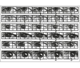Саккадическое глазодвижение в структуре нейролептического экстрапирамидного расстройства. Взгляд невролога