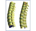 Comparative Data Analysis of the Physical and Mathematical Modeling of Explosive Thoracolumbar Spine Fracture
