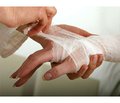 Application of ultrasound diagnostics in hemodynamic disturbances after operation in heavy hand injuries
