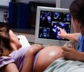 Роль гомоцистеїнемії в розвитку дистресу плодів у вагітних із багатопліддям 