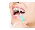 Роль інтердентальної гігієни в підтримці здоров’я порожнини рота