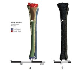 Біомеханічний аналіз надійності фіксації кісткових відламків при остеосинтезі переломів проксимального відділу великогомілкової кістки LCP-пластиною та інтрамедулярним блокованим стрижнем