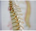 Calcium-phosphate ceramics in spine surgery: features of regeneration and use