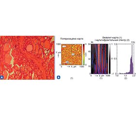 Патофізіологія дизрегуляційного і класичного патологічних процесів та можливості використання методів поляризаційної біомедичної оптики в діагностиці захворювань щитоподібної залози