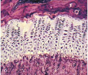 Влияние препарата мебивид на структурно-функциональное состояние костной ткани при алиментарном остеопорозе в эксперименте