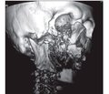 Патогенез и принципы лечения огнестрельных ранений челюстно-лицевой области в условиях многопрофильного лечебного учреждения