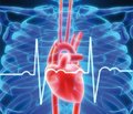 Нестандартные подходы к лечению острой сердечной недостаточности