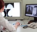 Клініко-рентгенологічні особливості остеомієлітів хребта