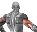 Лечение разрыва дистального сухожилия двуглавой мышцы плеча у спортсменов