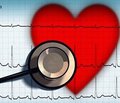Варіабельність ритму серця у хворих з ішемічною хворобою серця: вплив епідуральної анестезії